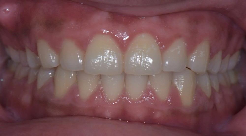 Before image