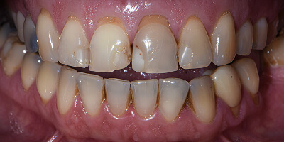 Before image