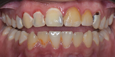 Before image