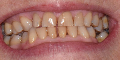 Before image