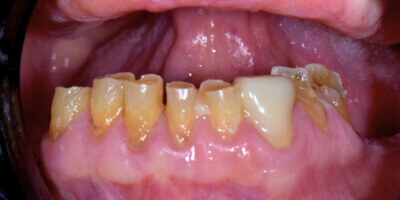 Before image
