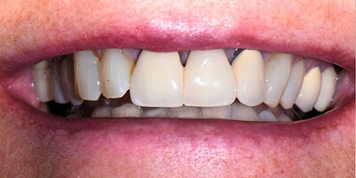 Before image