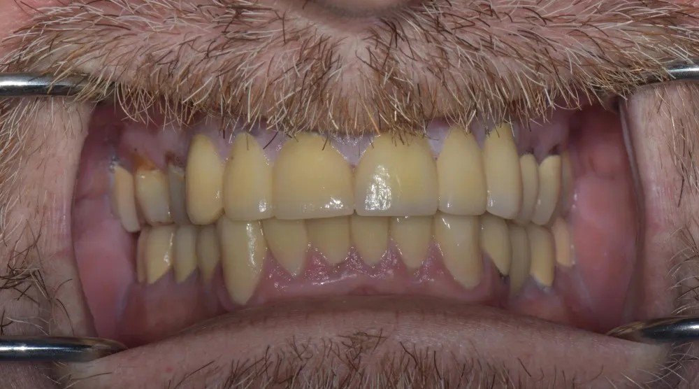 Before image