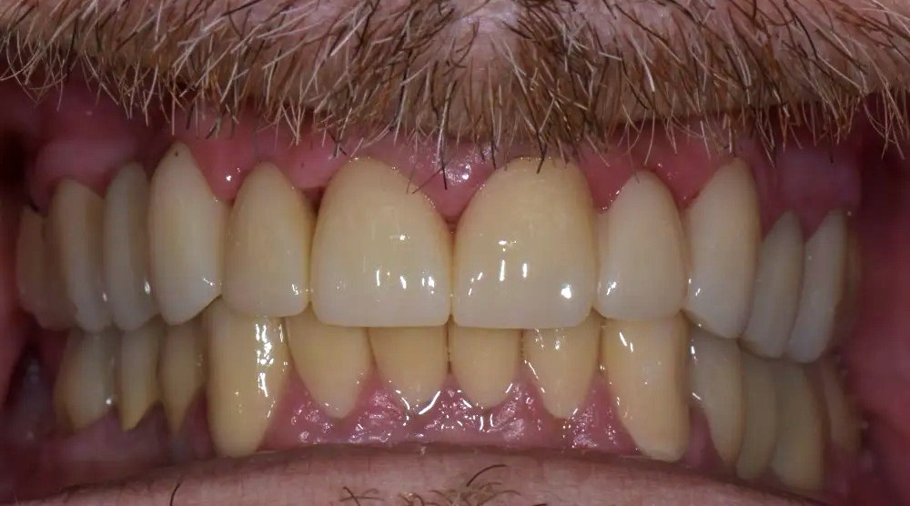 After image