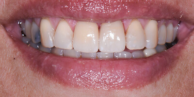 After image