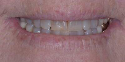 Before image